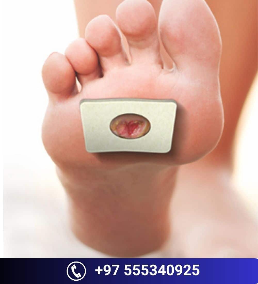 Prozole Adhesive Felt Pad