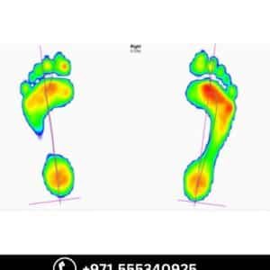 3D Print Custom Made Insole