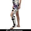 Hip Knee Ankle Foot Orthosis - Image 3