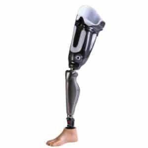 Above Knee Prosthesis
