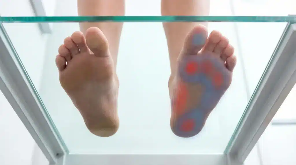 Side-by-side comparison of two bare feet on a glass surface viewed from below — one foot showing a healthy raised arch with a visible gap, and the other foot showing a completely flat arch pressing fully against the glass