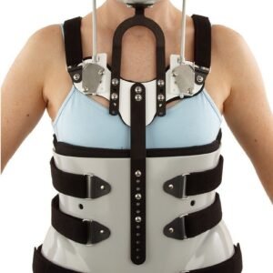 Thoraco-Lumbo-Sacral Orthosis (TLSO)
