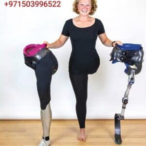 Hip Disarticulation Prosthesis