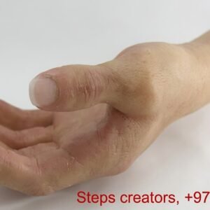 Silicone Hand Prosthesis (Passive/Cosmetic)