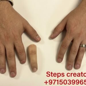 Silicone Finger Prosthesis