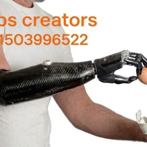 Below-Elbow Prosthesis (Transradial Prosthesis)