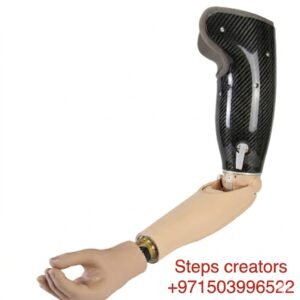 Above-Elbow Prosthesis (Transhumeral Prosthesis)