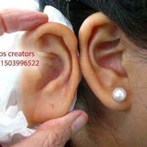 Silicone Ear Prosthesis (Auricular Prosthesis)