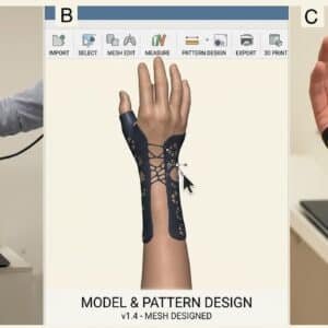 Wrist Hand Orthosis (WHO)